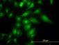 TRAPPC4 Antibody (monoclonal) (M01)